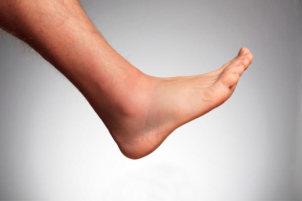 Exercícios para fascite plantar - Círculos com os tornozelos
