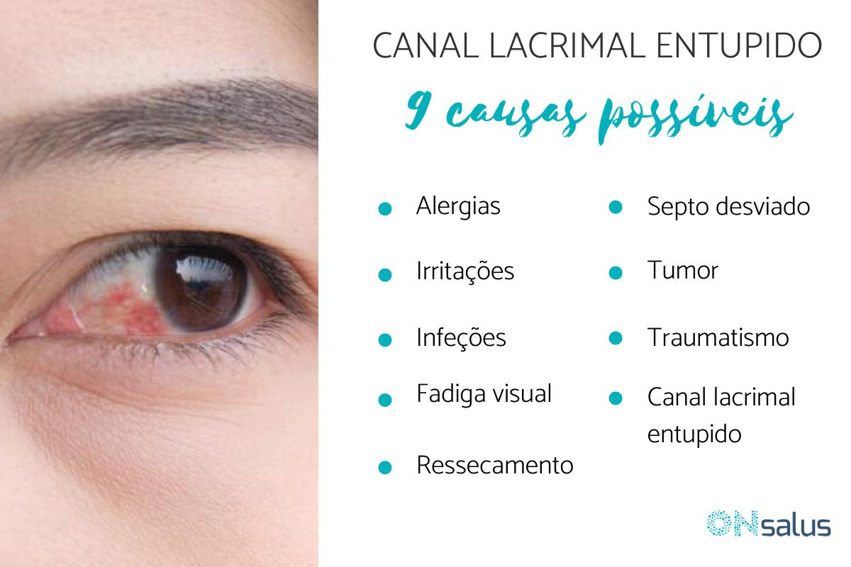 Canal lacrimal inchado e coçando, o que pode ser?