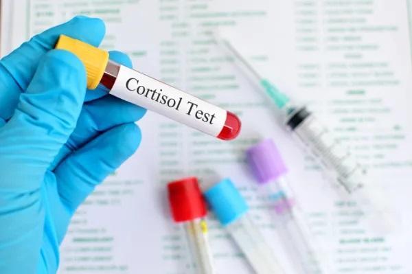 Cortisol elevado devido ao estresse: sintomas e como reduzi-lo - O que é cortisol