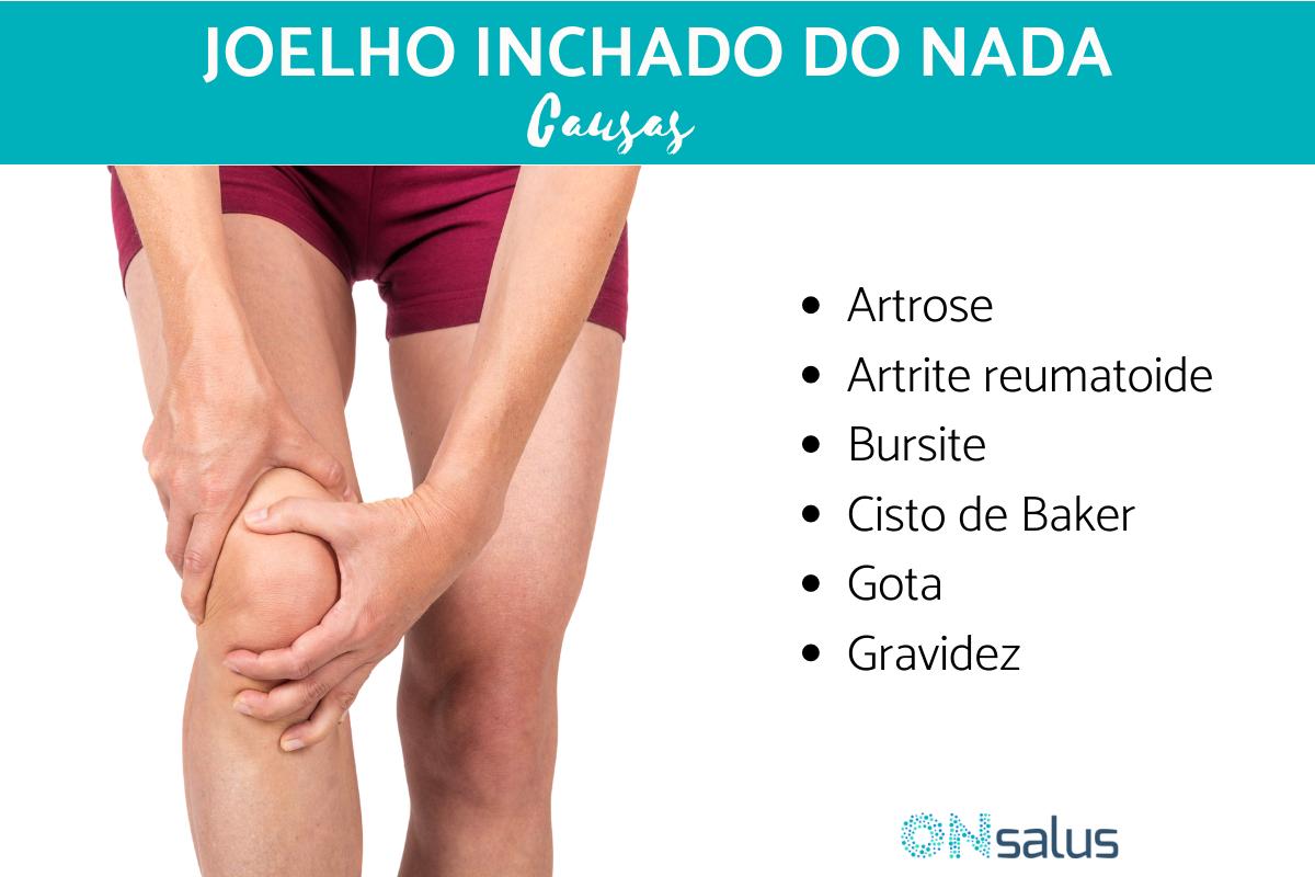 Joelho inchado do nada - Causas e tratamento