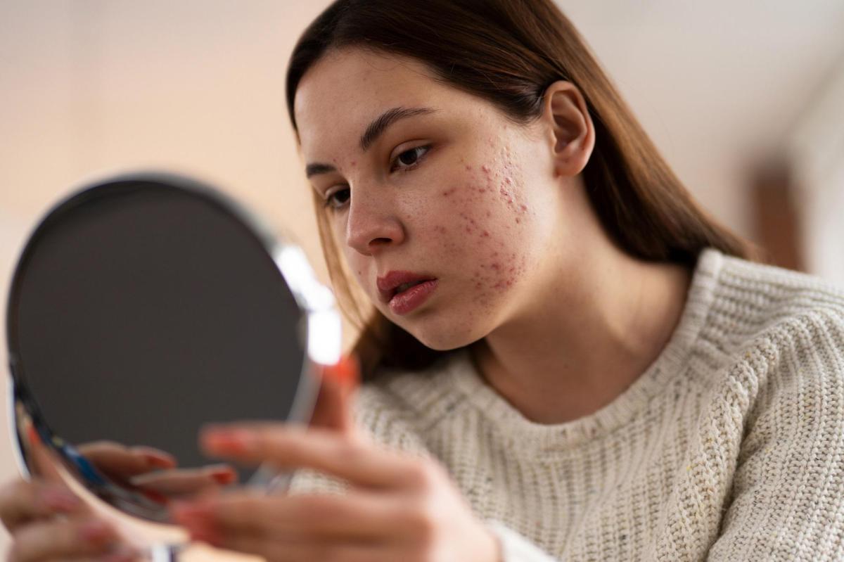 Testosterona alta em mulheres: causas, sintomas e como reduzi-la