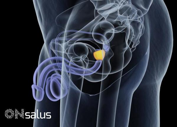 Próstata aumentada: sintomas, causas e tratamentos