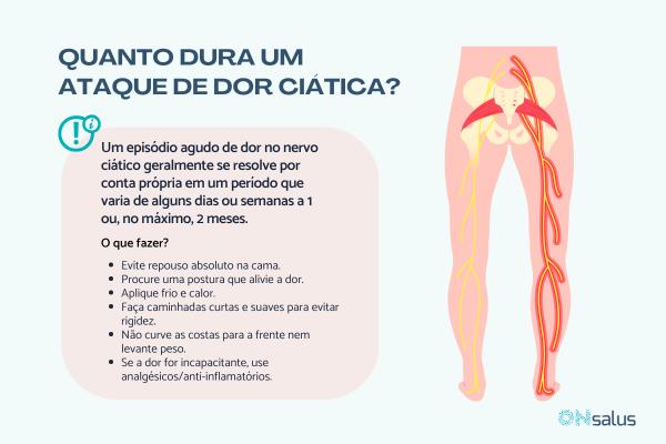 Quantos dias o nervo ciático fica doendo?