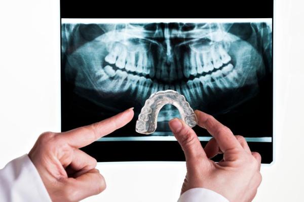 Ranger os dentes dormindo é normal? - Ranger os dentes dormindo: causas