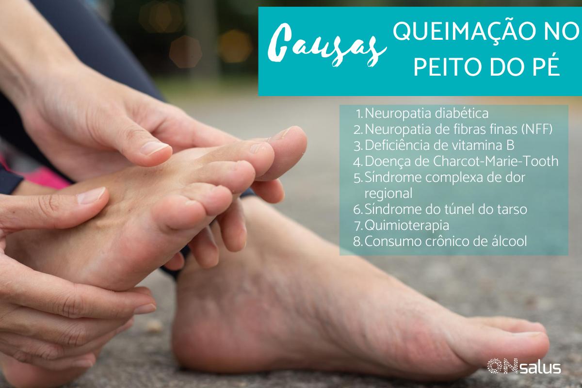 Queimação no Peito do Pé - Causas e Tratamento