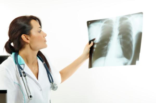 Fibrose pulmonar: causas, sintomas e tratamento - Diagnóstico da fibrose pulmonar