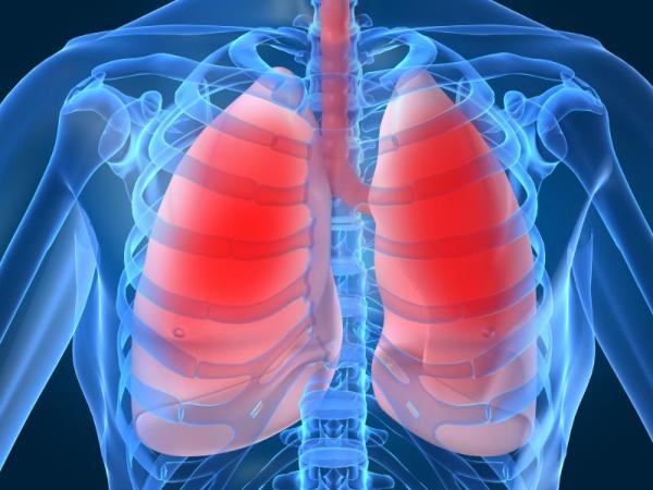 Fibrose pulmonar: causas, sintomas e tratamento