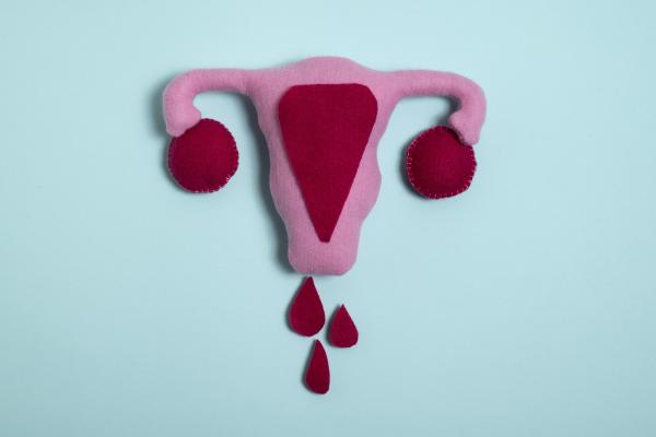 Por que minha menstruação veio pouca e escura? - Menstruação e suas variações normais