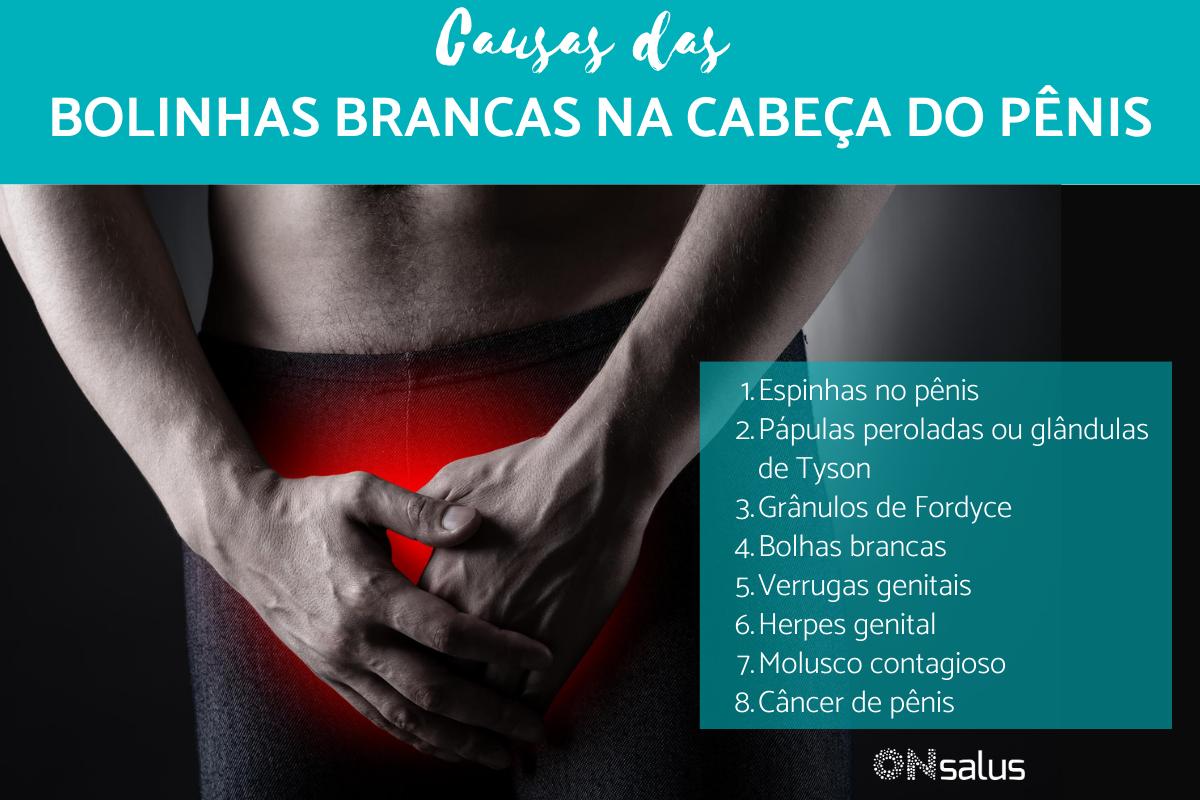 Bolinhas Brancas Na Cabeça do Pênis: Causas e Tratamento