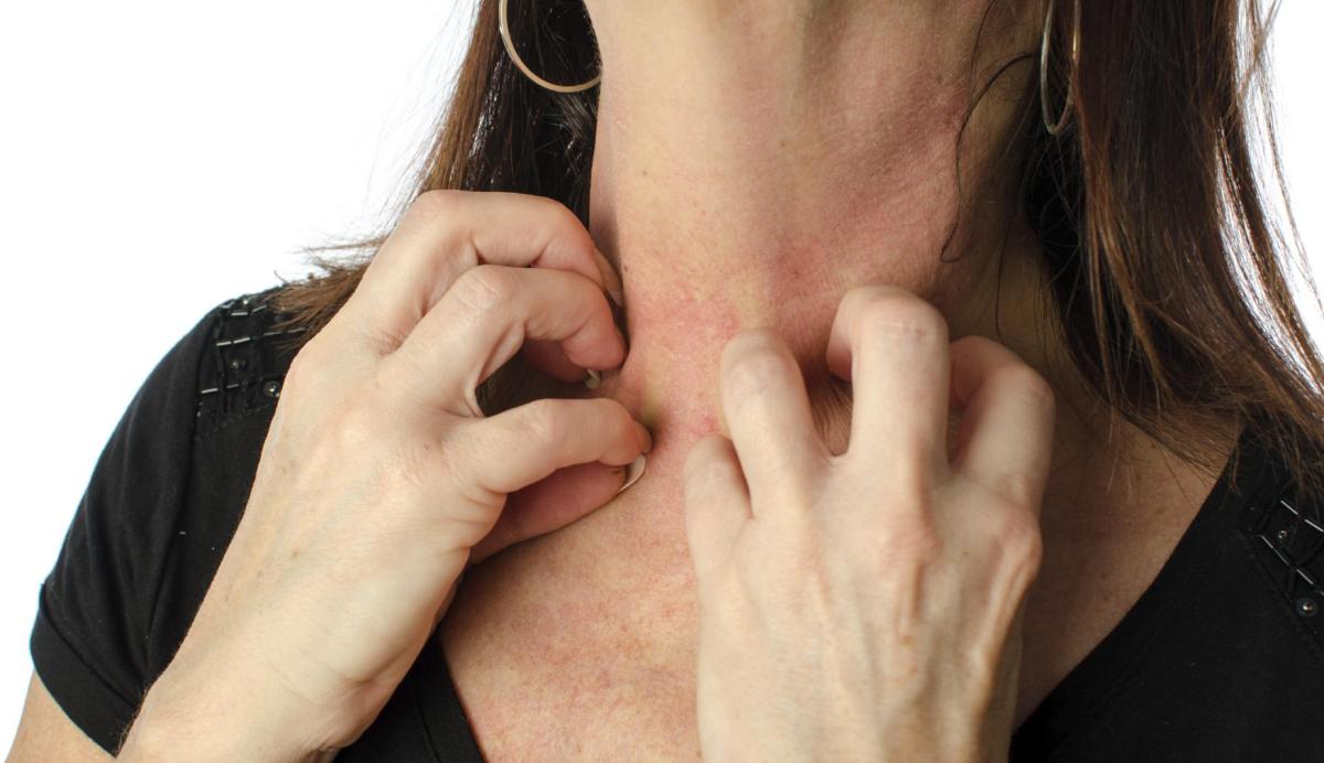 Alergia nervosa: sintomas e tratamento
