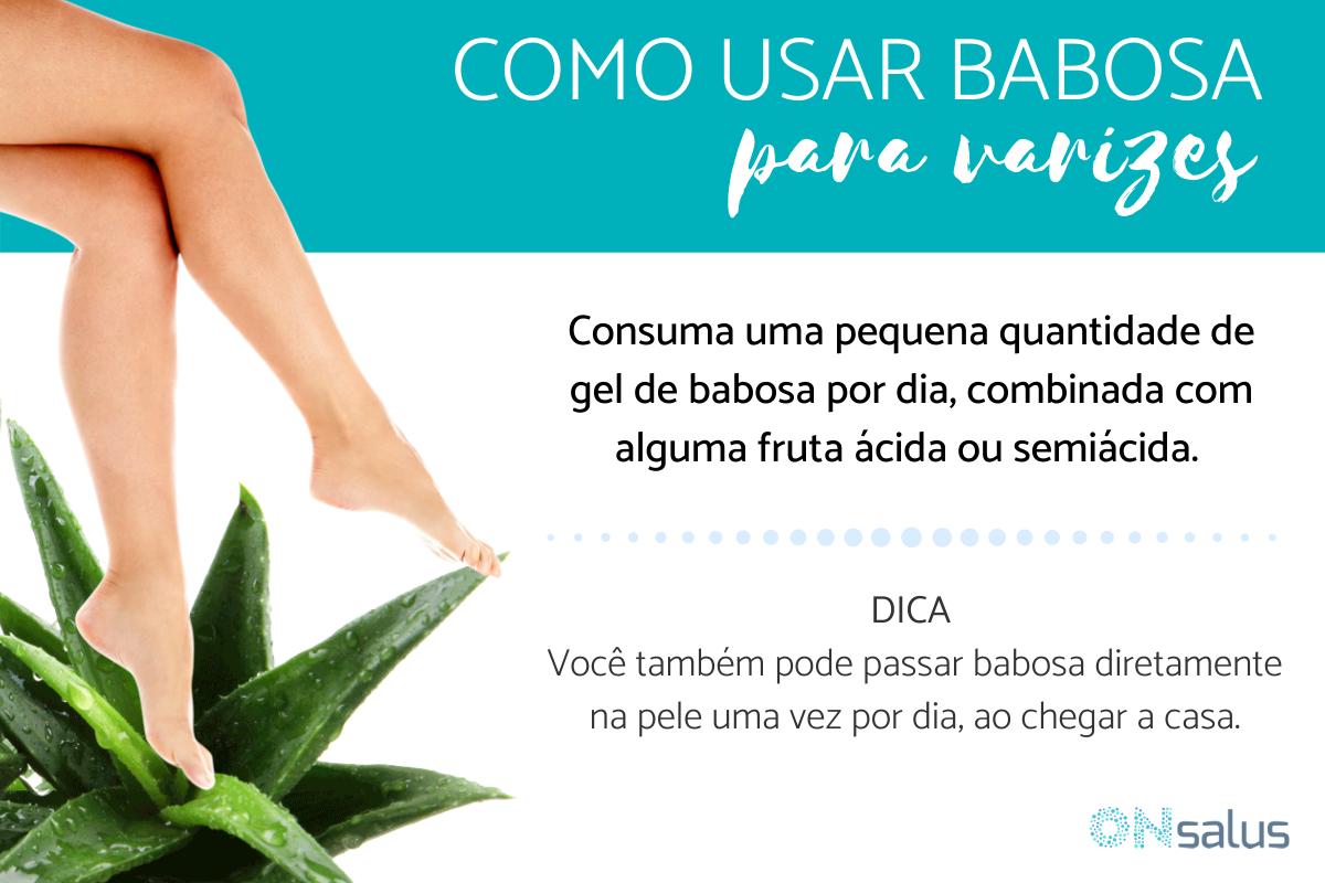 Babosa para varizes: benefícios e como usá-la