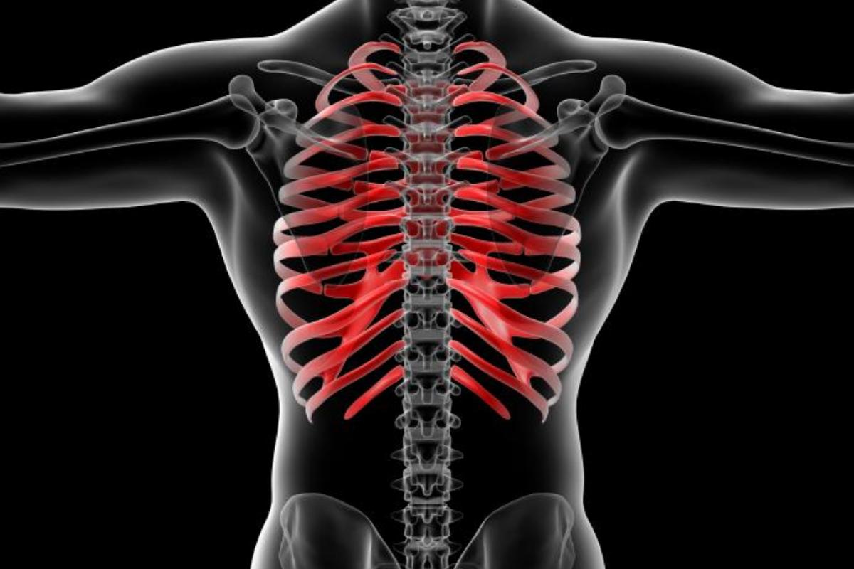 Costocondrite: sintomas e tratamento