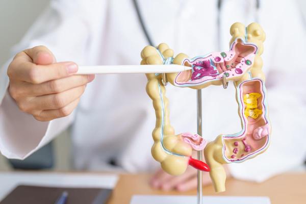 Gases e dor nos ovários: causas e tratamento - Síndrome do intestino irritável 