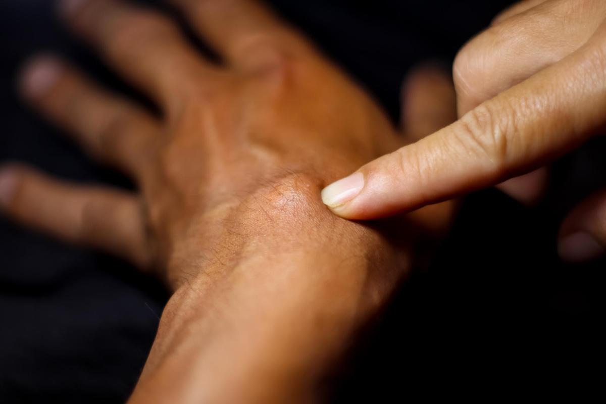 Caroço duro no pulso com dor - Causas e como tratar
