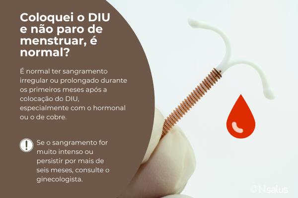 Coloquei o DIU e não paro de menstruar