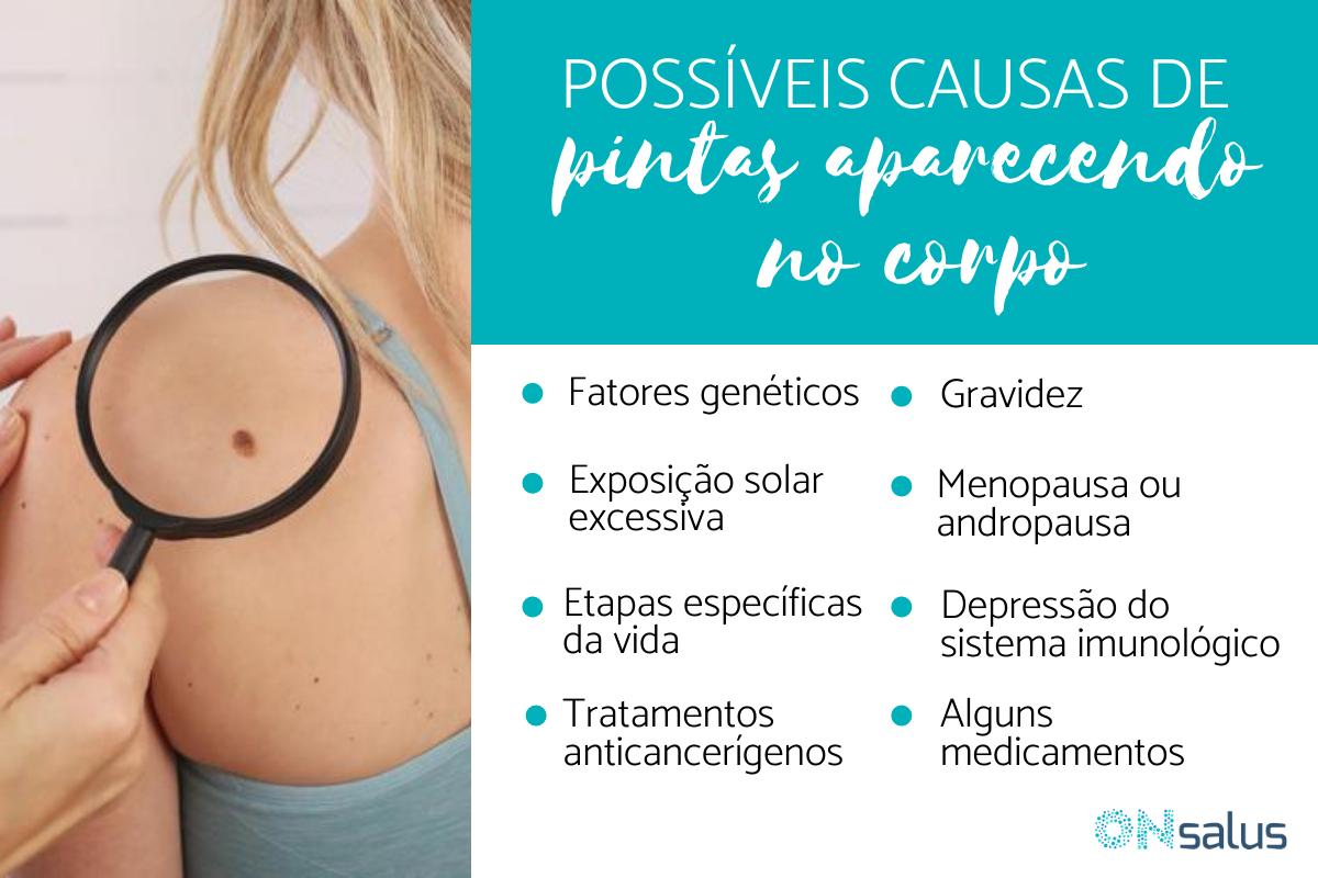 Muitas pintas aparecendo no corpo, o que pode ser?