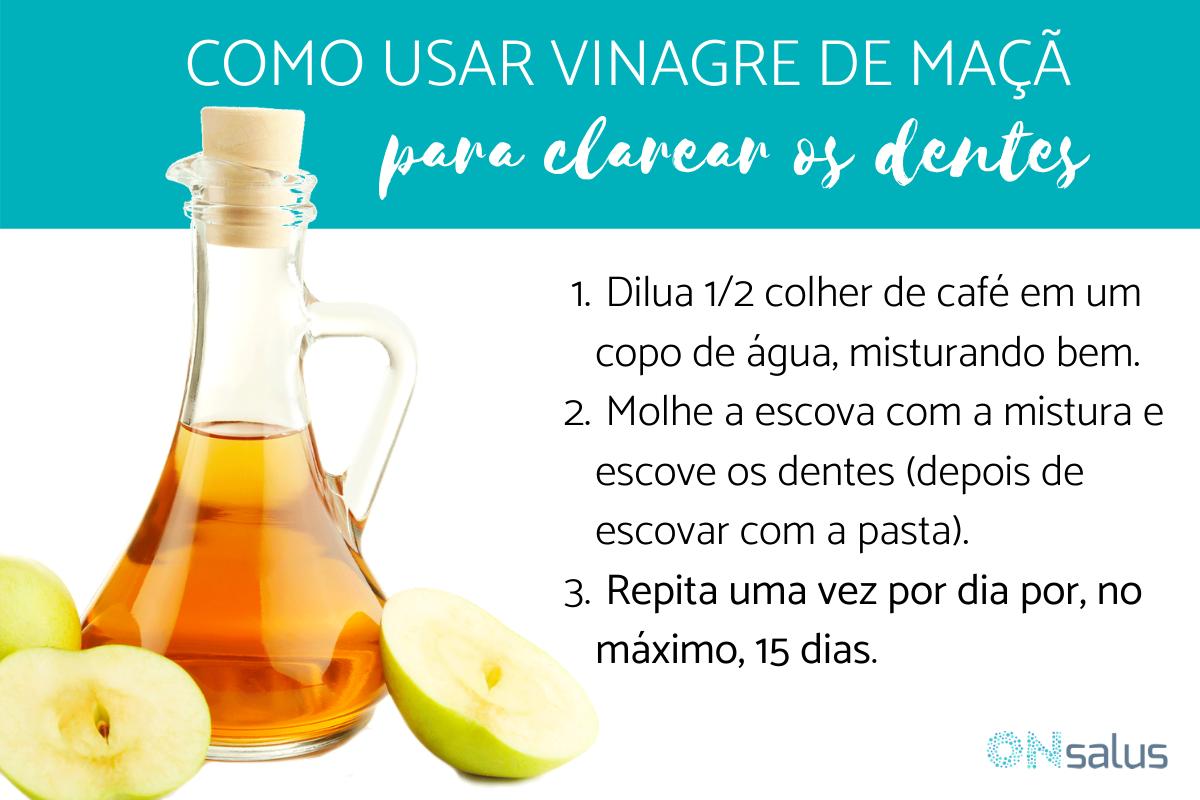 Vinagre de maçã para clarear os dentes: como usá-lo