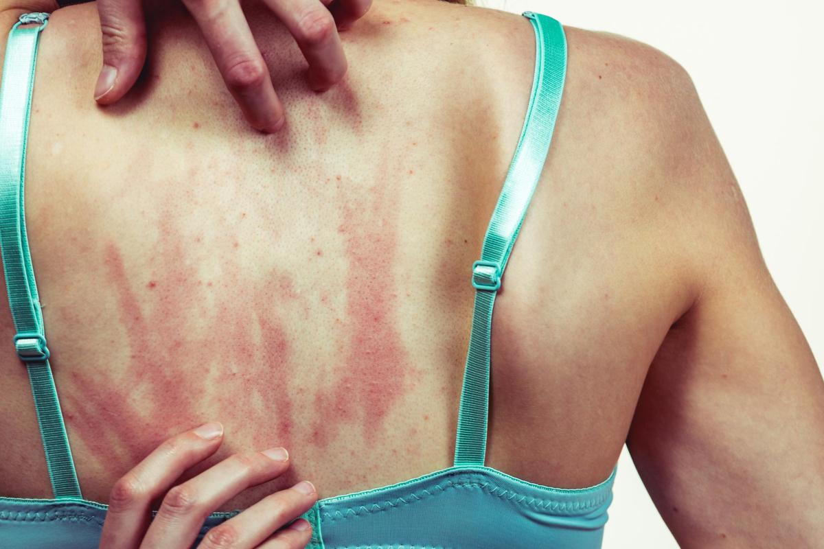 Corpo Pinicando e Coçando Sem Nada Aparente: Causas e Tratamento