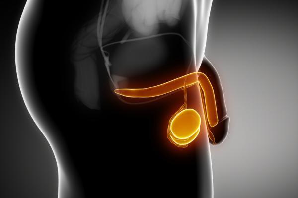 Testículo inflamado: causas e tratamento