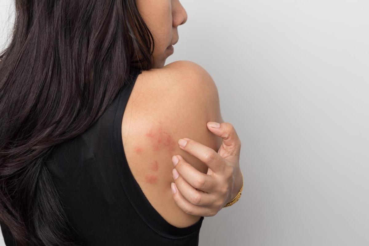 Alergia nervosa: causas e tratamento