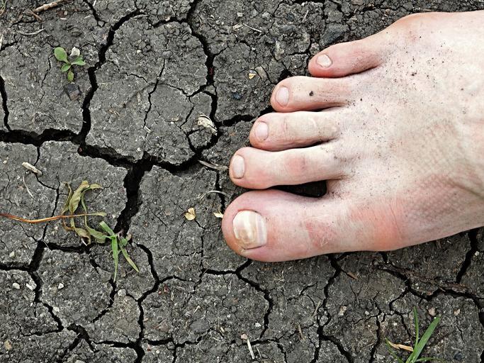 Caroço em cima do pé: o que pode ser - Sintomas e tratamentos